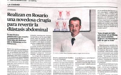 Cómo es la novedosa cirugía para revertir la diástasis abdominal – Nota en La Capital